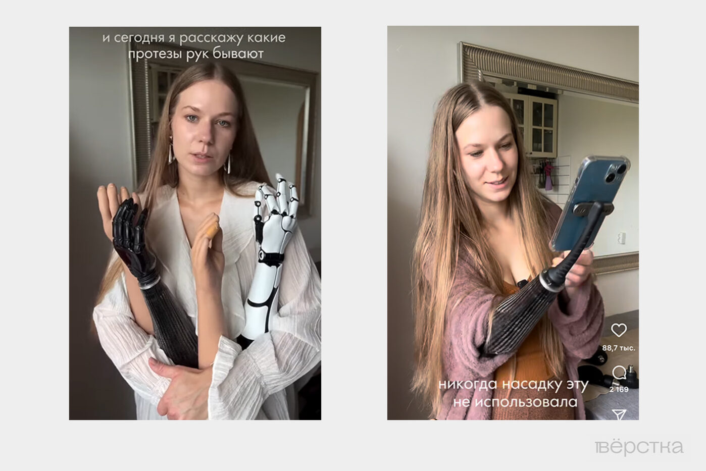 Качественные протезы рук позволяют повторять основные движения, но Социальный фонд может отказать в их покупке — стоят такие протезы слишком дорого